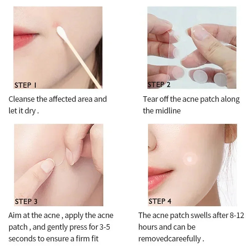 Pimple Anti-Acne Hydrocolloid Patches