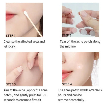 Pimple Anti-Acne Hydrocolloid Patches