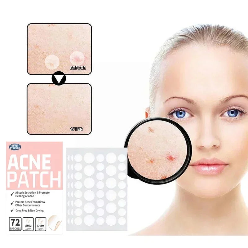 Pimple Anti-Acne Hydrocolloid Patches