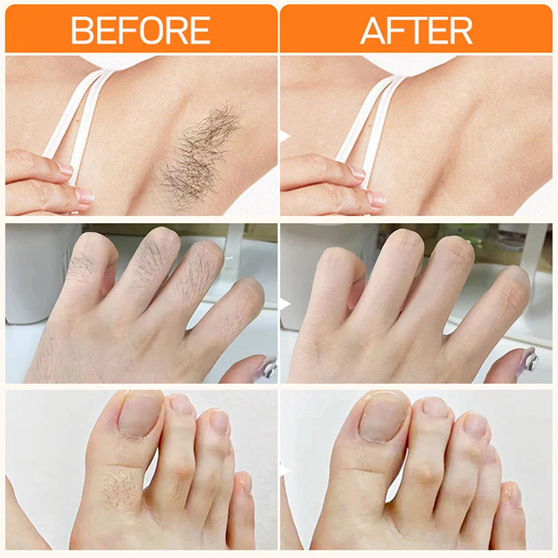 Fast Gentle Hair Removal Skin Care